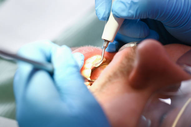 Best Emergency Treatment for Dental Infections or Abscesses in Ashdown, AR